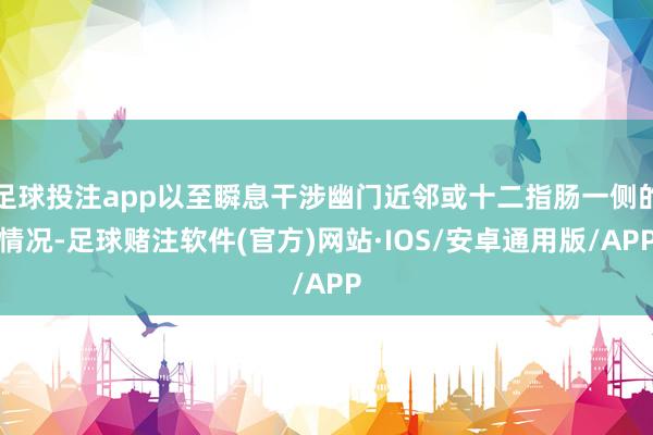 足球投注app以至瞬息干涉幽门近邻或十二指肠一侧的情况-足球赌注软件(官方)网站·IOS/安卓通用版/APP